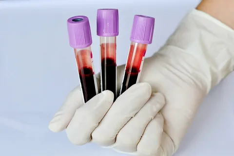 blood analysis Melbourne