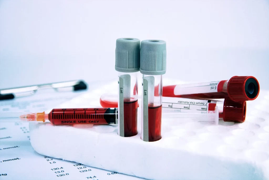 blood analysis Melbourne