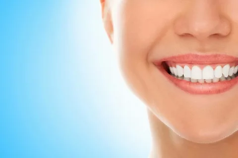 Teeth whitening Marrickville