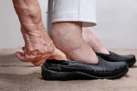 Adjustable Slippers For Swollen Feet